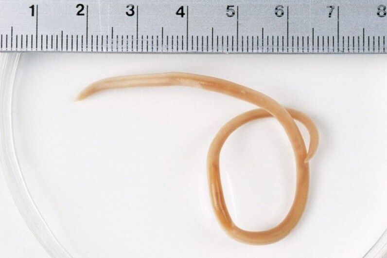 the size of a worm in the body