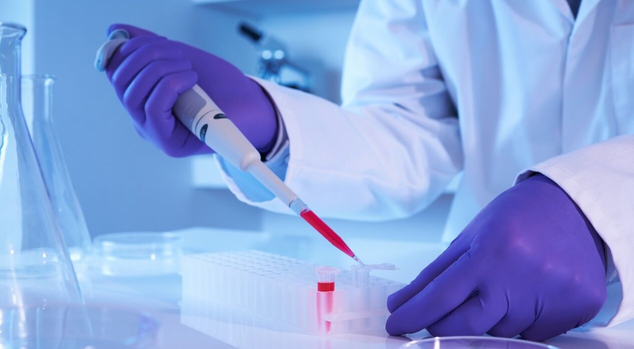How to take parasite analysis
