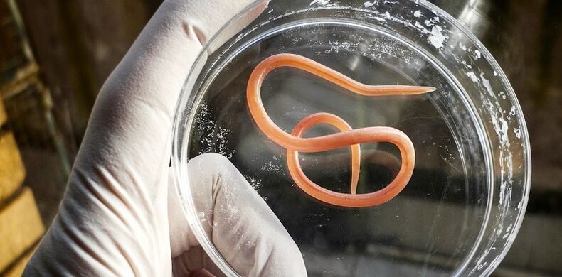 parasites from the human body