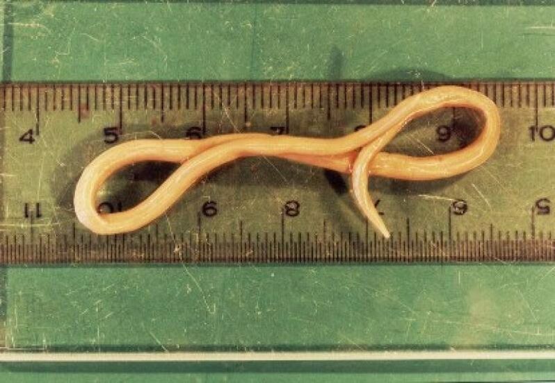 a parasite of roundworms from the human body