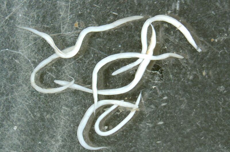 a worm parasite from the human body