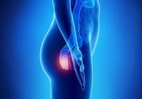 itching in the rectum as an indication for testing for parasites