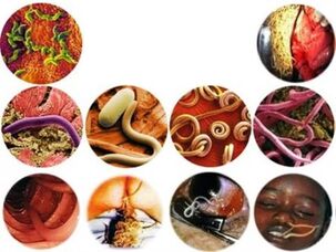How to remove parasites from the body folk remedies